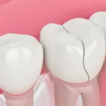 The benefits of regular dental care